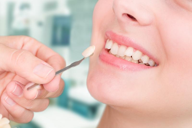 Реставрация зубов: основные методы и материалы